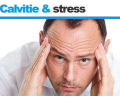 CALVITIE ET STRESS